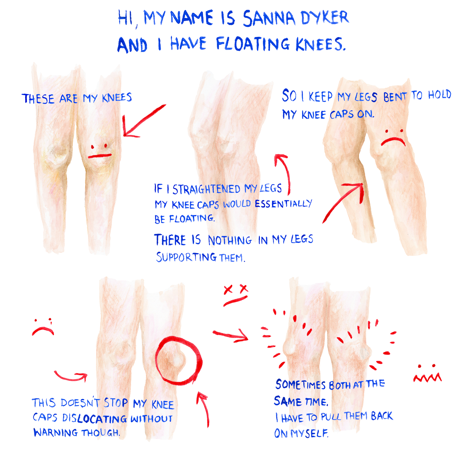 floating knees June 2016