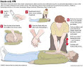 CPR Technique how to perform cpr