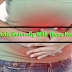 Treat Gastritis Naturally With These Home Remedy