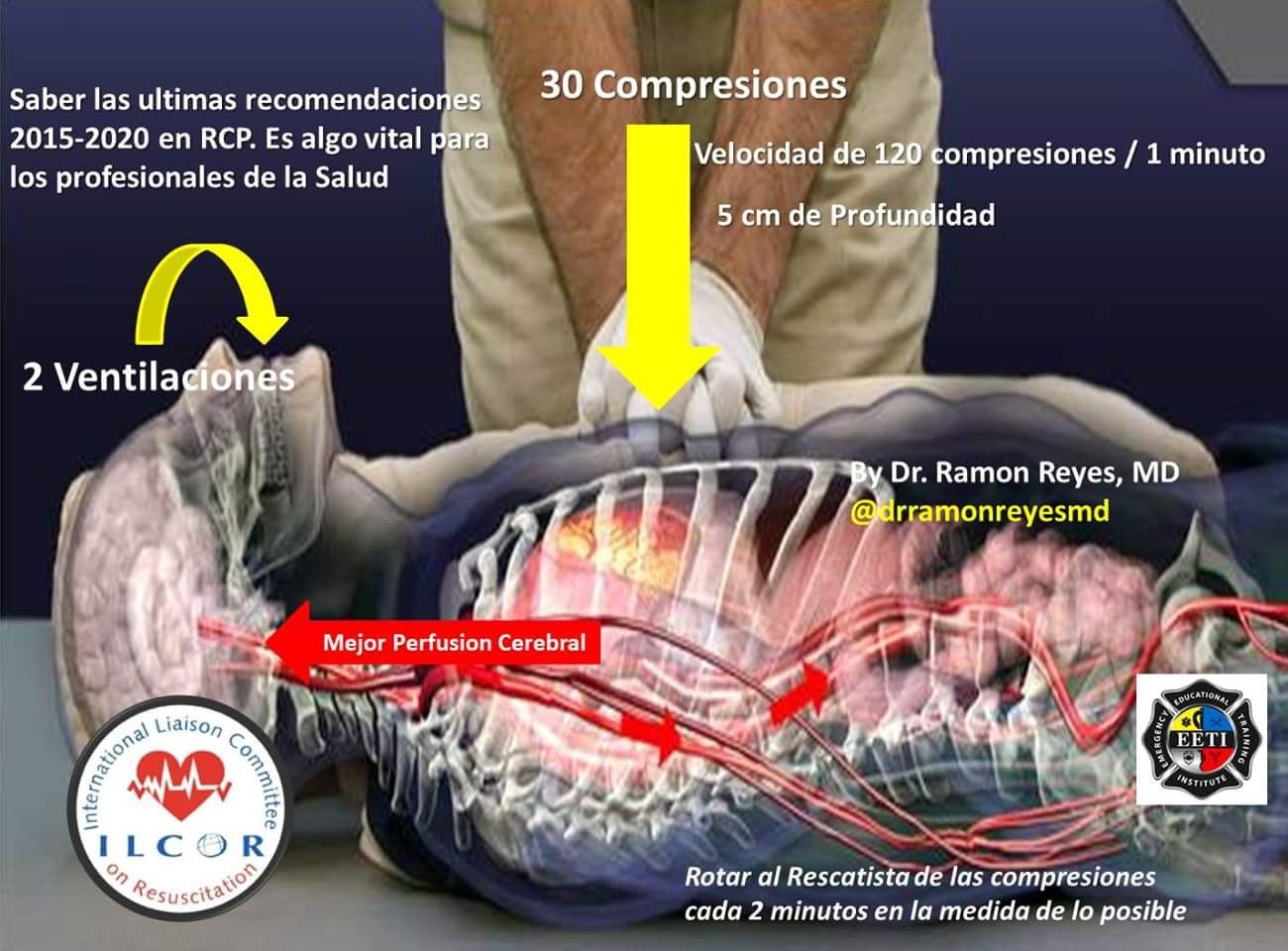 EMS SOLUTIONS INTERNATIONAL by @DrRamonReyesMD marca registrada: RCP ...