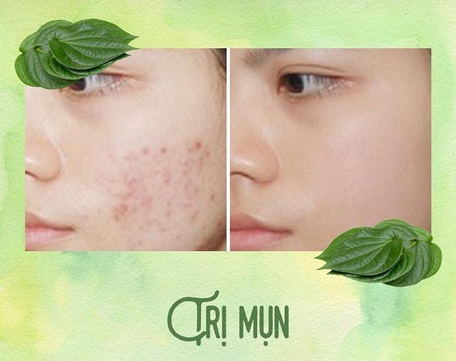 công dụng làm đẹp hiệu quả từ trầu cong-dung-lam-dep-hieu-qua-tu-trau