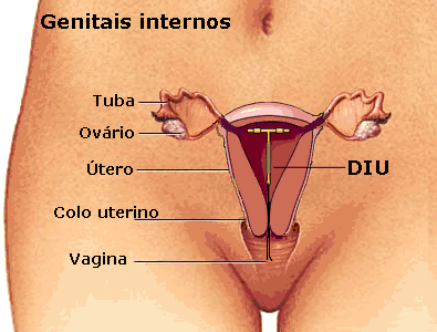 DIU_5.gif