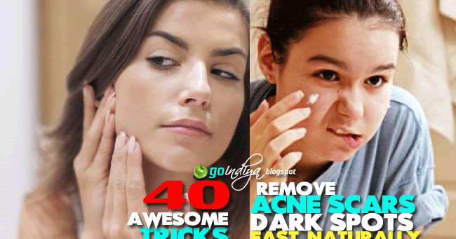 Natural Way To Get Rid Of Cat Dandruff Natural Way To Get Rid Of Cat Dandruff