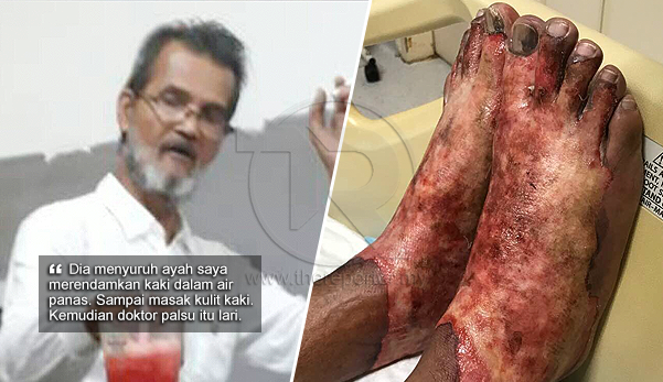"Sampai masak kulit kaki ayah saya dibuatnya!" - Anak dedah 'doktor palsu' aniaya bapanya