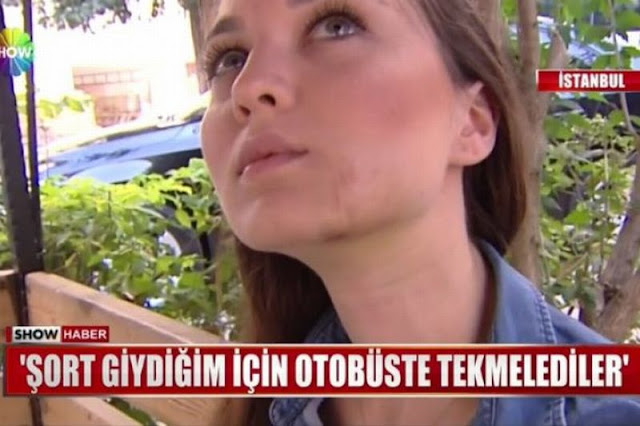 Perempuan Cantik Turki ini Ditendang Wajahnya, Karena Memakai Celana Pendek