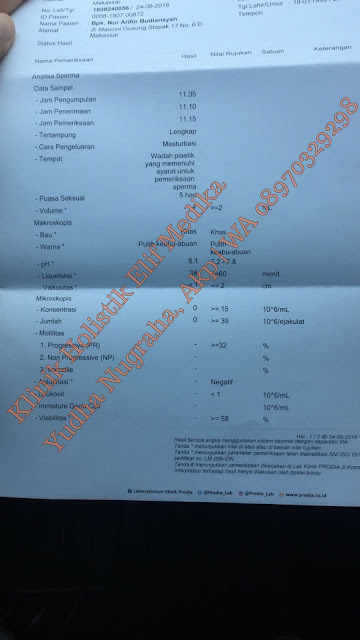 Tahap 1 pengobatan : Hasil masih Azoospermia Tahap 1 pengobatan : Hasil masih Azoospermia