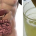 Remove All Toxins From the Body in 3 Days: A Method That Prevents Cancer, Removes Fat and Excess Water!