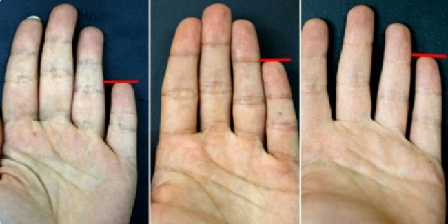 Pogledajte svoj mali prst! – Evo šta mali prst na ruci može reći o vama