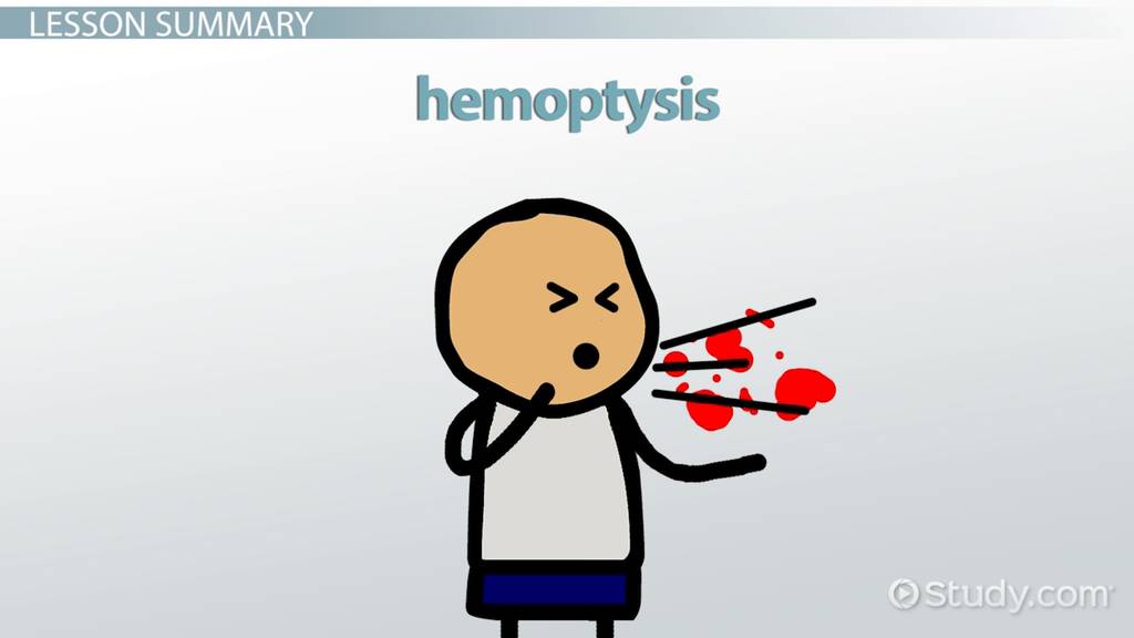 гемоптизис. гемоптизис. Ers guide treatment massive hemoptysis. гемоптизис. геморрагический бронхит.