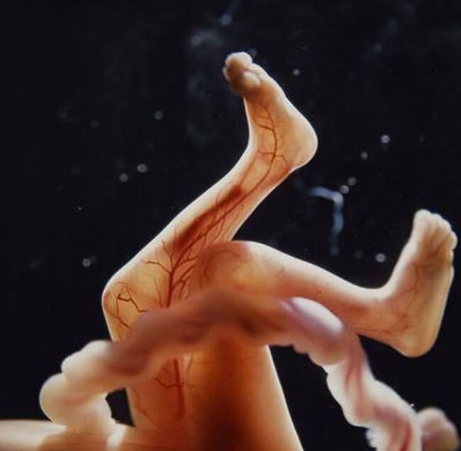 22 Stunning Pictures Depict The Stages Of A Baby Developing Before It Is Born