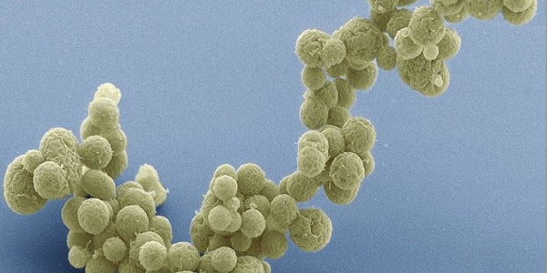 Ilmuwan Berhasil Menciptakan Bakteri Sintetik