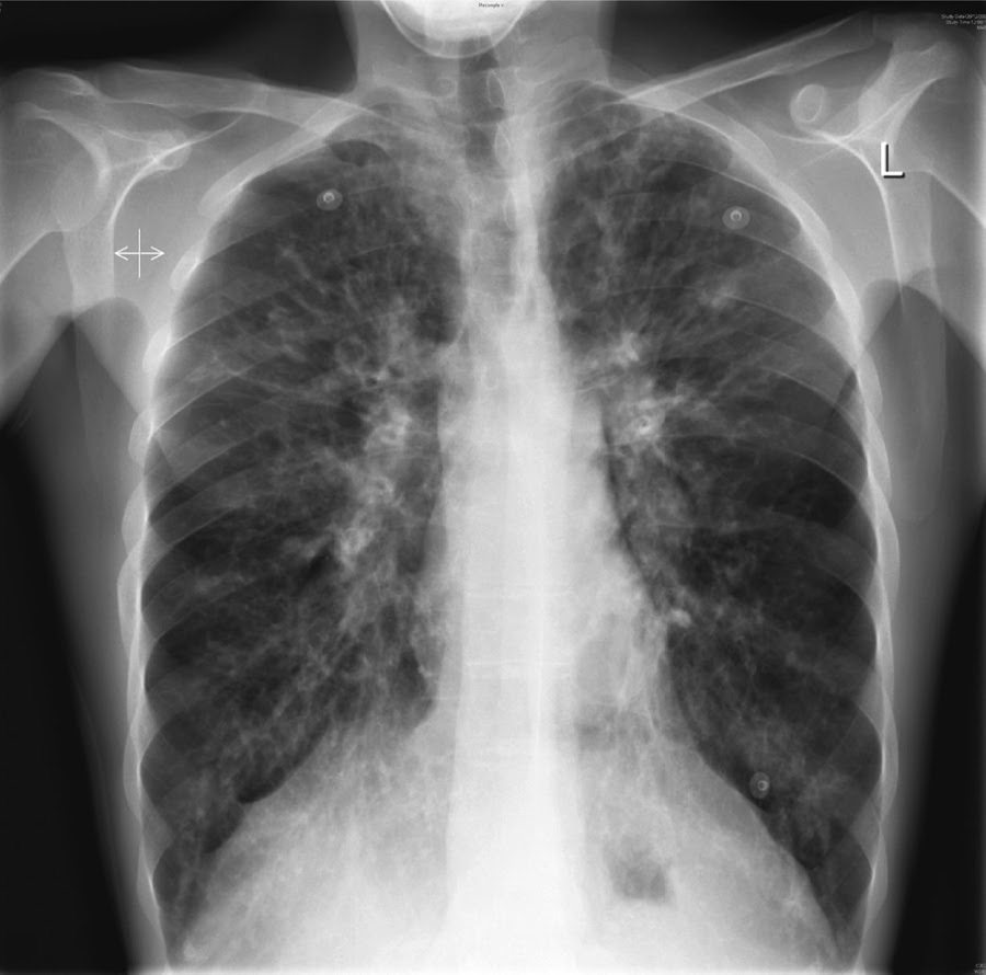 Prepare for Medical Exams A 19yearold boy has a history of repeated