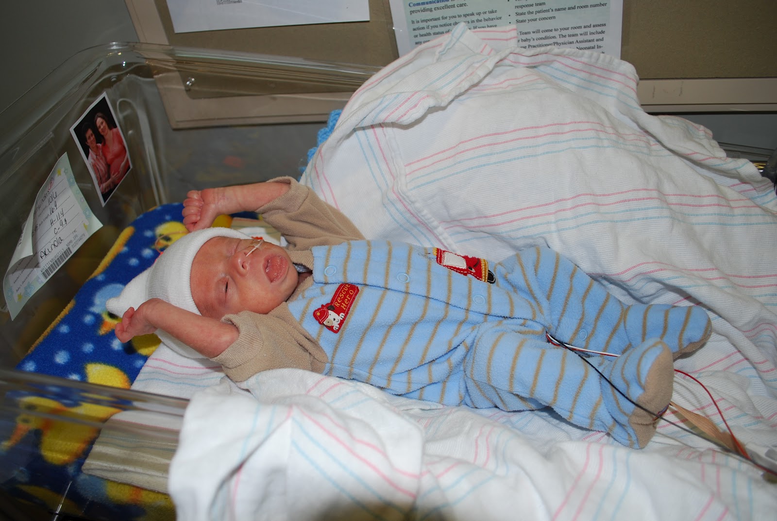 30 Fingers, 30 Toes... Emergency CSection vs Emergency Surgery