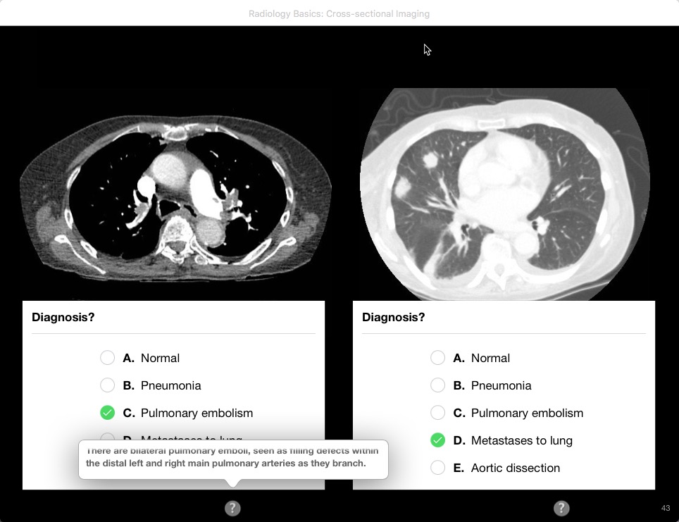 Radiologia en Radiology Basics Crosssectional Imaging An E
