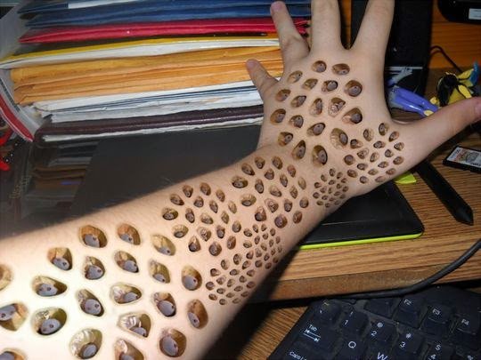 Trypophobia, Gangguan yang Membuat Merinding, Ternyata Ada Karena Kutu Jigger yang Ganas