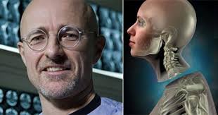 human head transplant