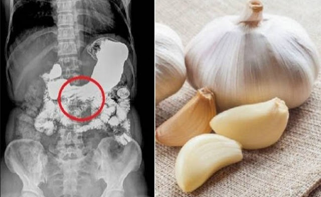 Does levitra work better on an empty stomach