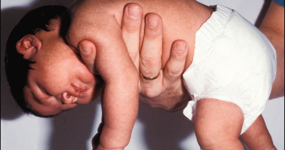 как снять тонус мышц у грудничка в 1 месяца. детский массаж грудничкам. гипертонус нормотонус гипотонус. тонус мышц у новорожденного. массаж при гипотонусе у новорожденного.