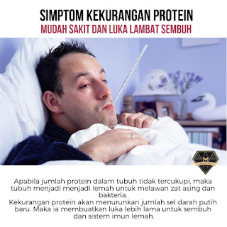 8 Simptom Kekurangan Protein 8 Simptom Kekurangan Protein
