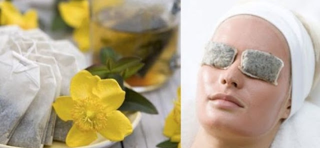 INILAH Cara Mudah Menghilangkan Kantung Mata dengan Es ...