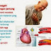 Obat Alternatif Penyakit Jantung Koroner thumbnail