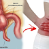 Here's The Real Causes of Appendicitis and Possible Complications- You Need To Know!