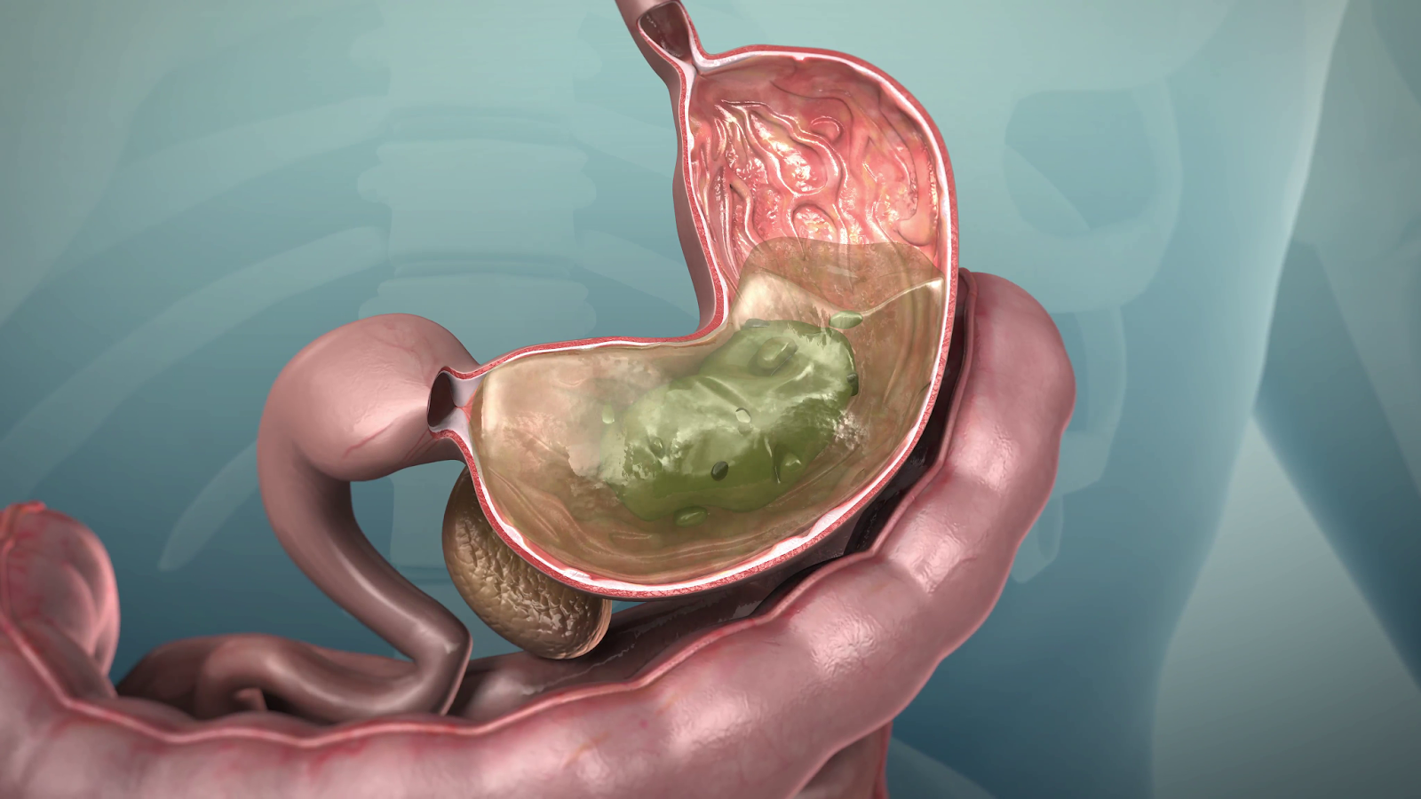 Stomach Pain When Eating Food Stomach Pain When Eating Food