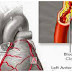 SAVE YOUR HEART, KIDNEYS, AND BRAIN: CLEAN YOUR ARTERIES WITH THESE 3 INGREDIENTS