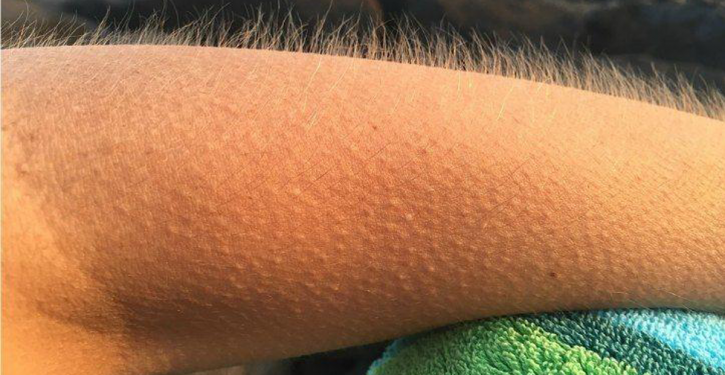 If The Music Gives You Goose Bumps It's Possible That Your Brain Is Special