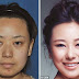 Wanita China Paling Ramai Lakukan Pembedahan Kosmetik Untuk Kelihatan Cantik