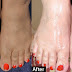 This Is Not A Joke. With Toothpaste You Can Do Pedicure At Home