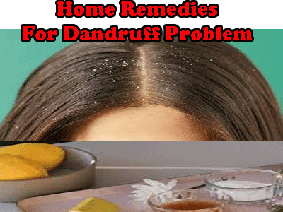 dandruff problem solution at home home remedies of dandruff problem