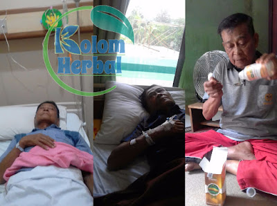Cara Mengobati Kandung Kemih Turun Pada Wanita