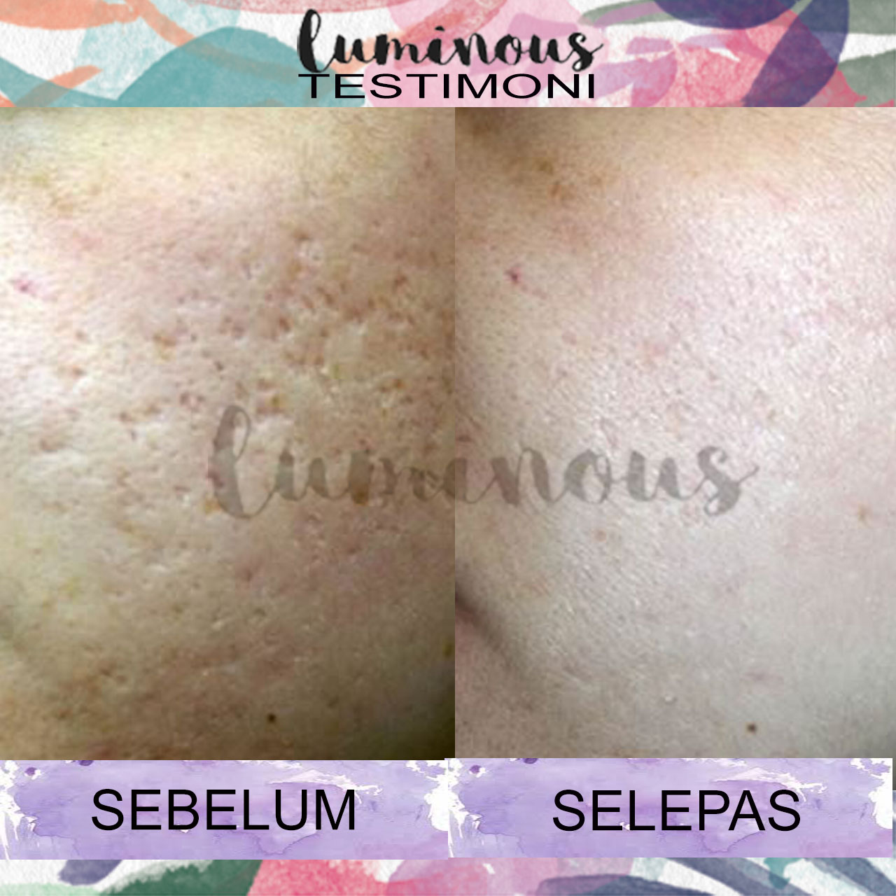 kebaikan nivea luminous spot clear