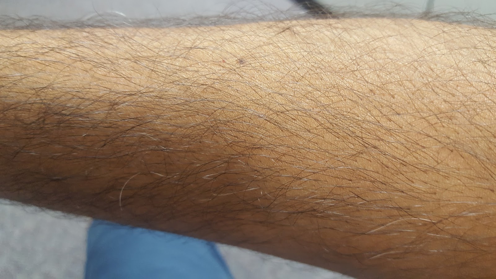arm hairy picture Amateur granny tgps