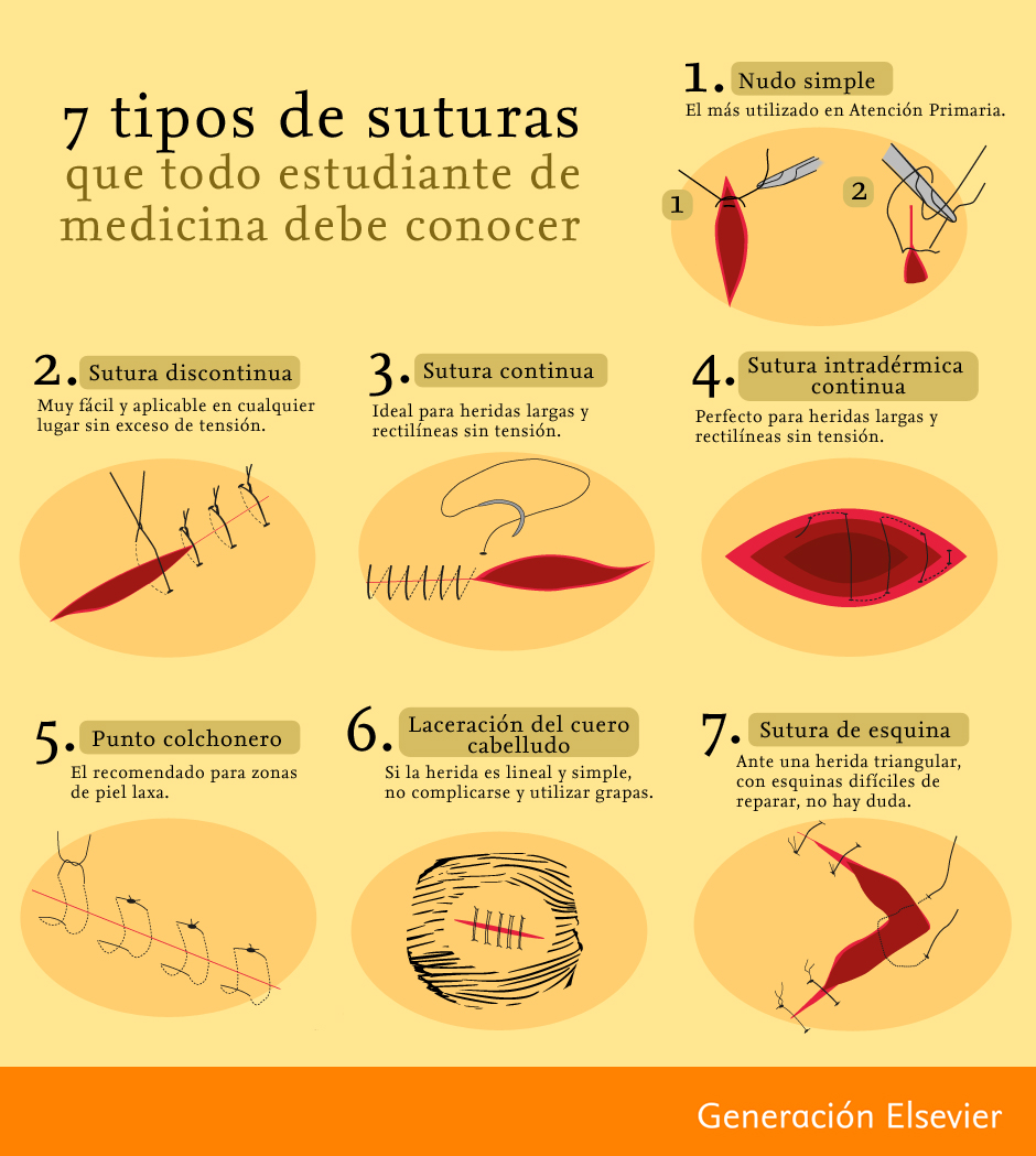 O Que São Suturas EPNEDU