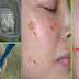 How To Use Coconut Oil and Baking Soda To Remove Wrinkles, Age Spot and Dark Spot