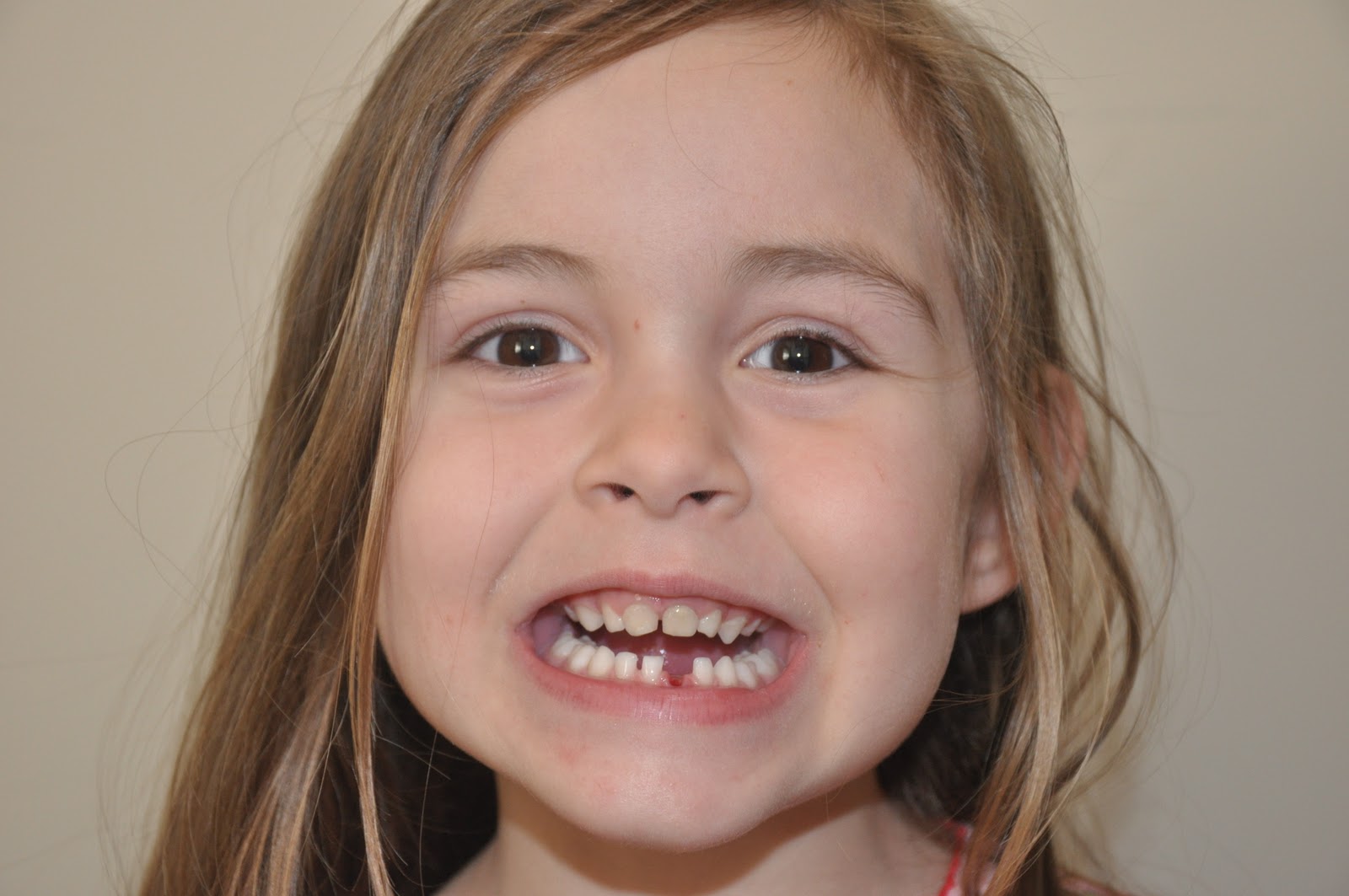 Sometimes I Craft Myself Lost Tooth 