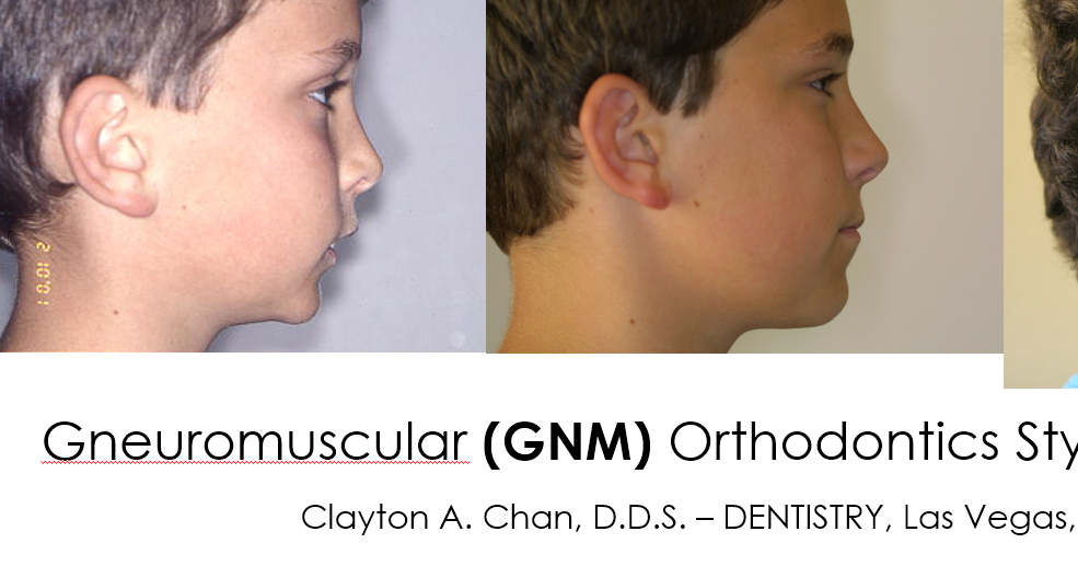 ORTHO 1 Fundamentals of Orthodontics & Dentofacial Orthopedics ORTHO 1