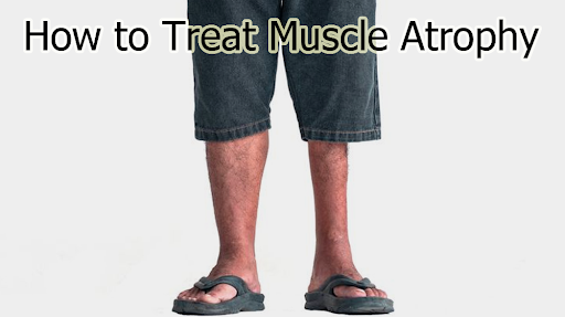 How to Treat Muscle Atrophy