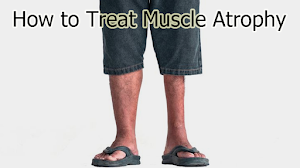 How to Treat Muscle Atrophy How to Treat Muscle Atrophy