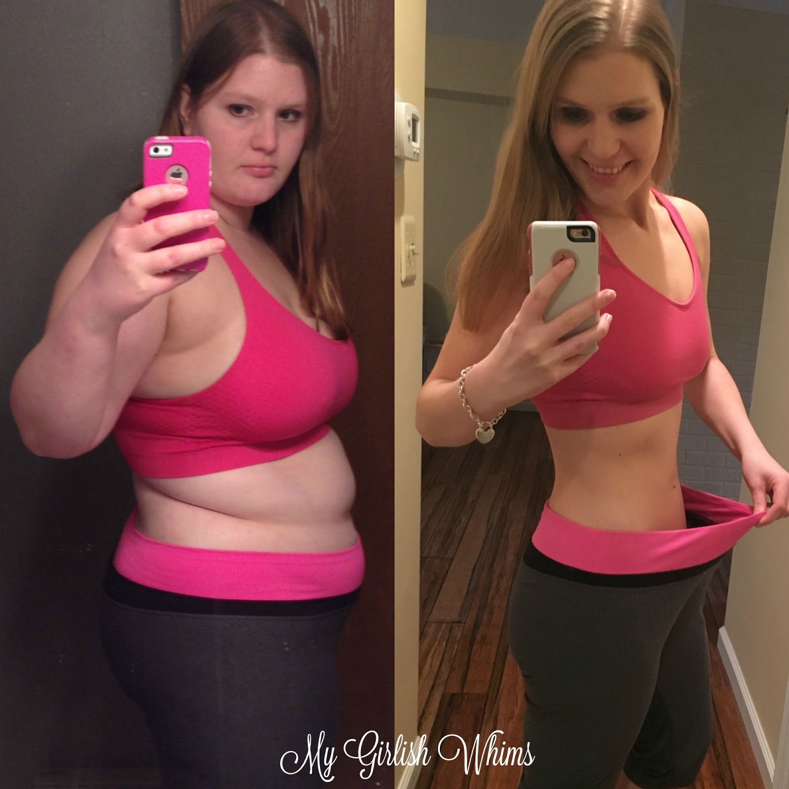 Communication on this topic: I Lost 142 Pounds By Watching My , i-lost-142-pounds-by-watching-my/ Discussion on this topic: I Lost 142 Pounds By Watching My , i-lost-142-pounds-by-watching-my/