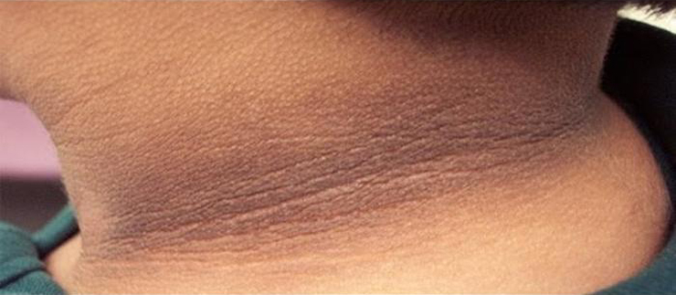 How To Brighten Your Skin Naturally
