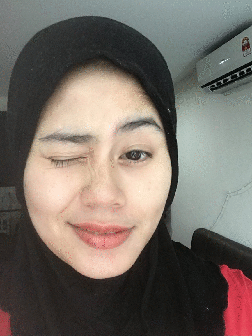 radiant skin in malay