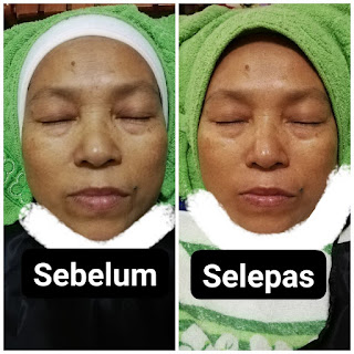 mobile spa, Youth kursus spa, kursus mobile spa, TWB, The Walking Beauty, belajar spa, kursus berpantang, jana income, cari kerja, cari duit, youth shaklee
