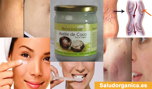 aceite de coco y bicarbonato para el acne