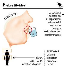 la fiebre tifoidea es un virus o una bacteria