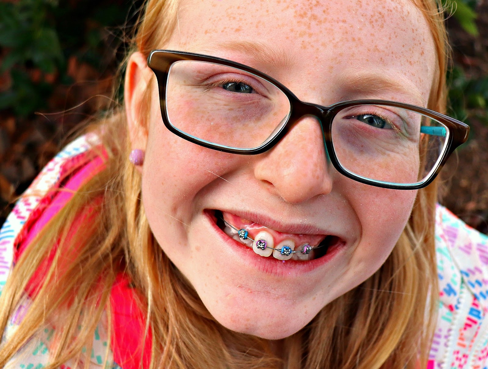 carolina on my mind Savannah's Braces