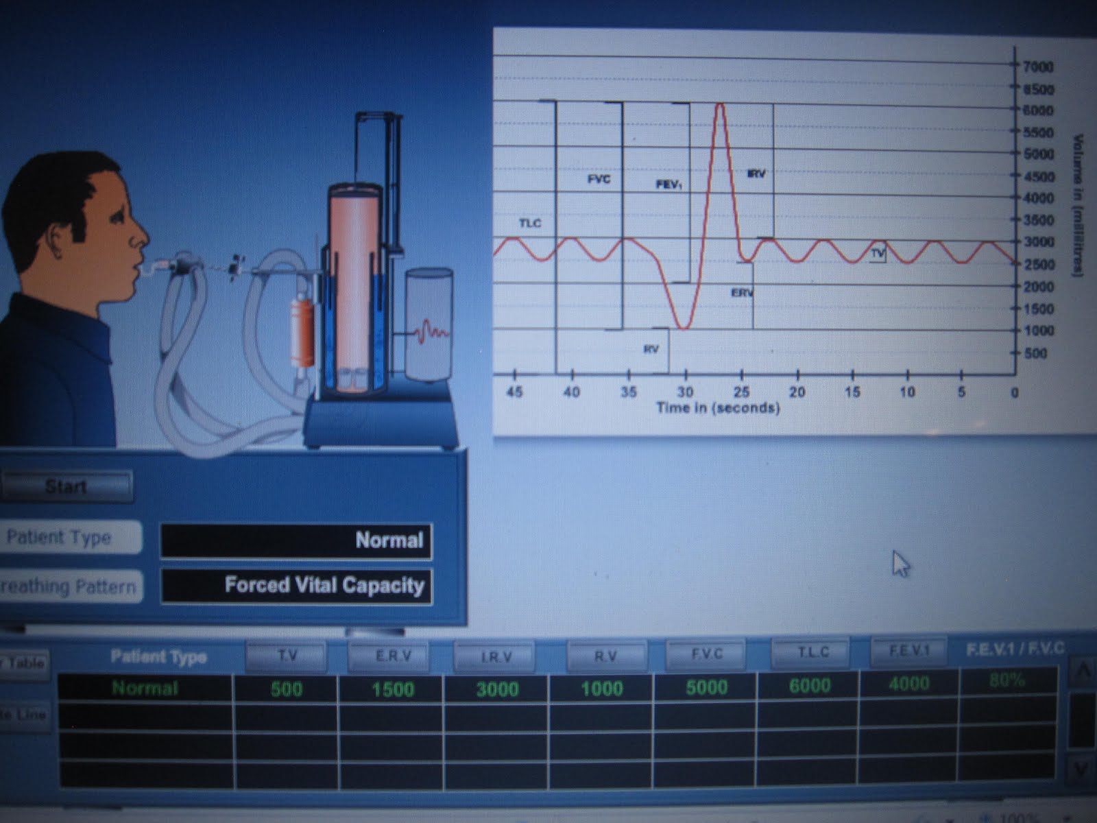 Brenda's A & P Eportfolio Objective 50 Demonstrate spirometer use and