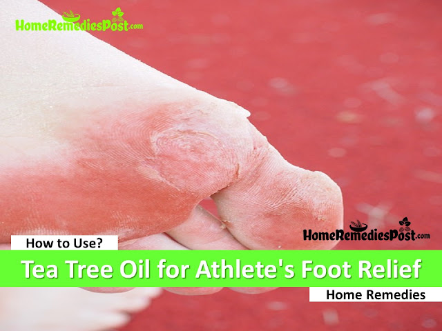 tea tree oil for athlete’s foot, how to use tea tree oil for athlete’s foot, how to get rid of athlete’s foot, home remedies for athlete’s foot, athlete’s foot treatment overnight fast, athlete’s foot fungus treatment, athlete’s foot relief, athlete’s foot home remedies, how to treat athlete’s foot, how to cure athlete’s foot, athlete’s foot remedies, remedies for athlete’s foot, cure athlete’s foot, treatment for athlete’s foot, best athlete’s foot treatment, how to get relief from athlete’s foot, relief from athlete’s foot, how to get rid of athlete’s foot fast,